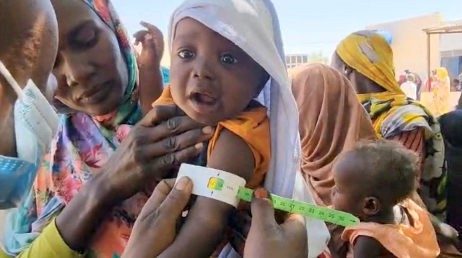 A child gets tested for malnutrition at a World Food Program camp at el-Fasher in Darfur, Sudan, March 27, 2025, in this screengrab obtained from a video. (OSV News/WFP Handout via Reuters)