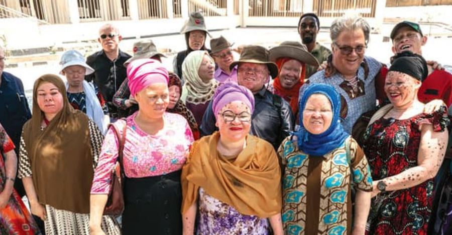 Ministry for People with Albinism