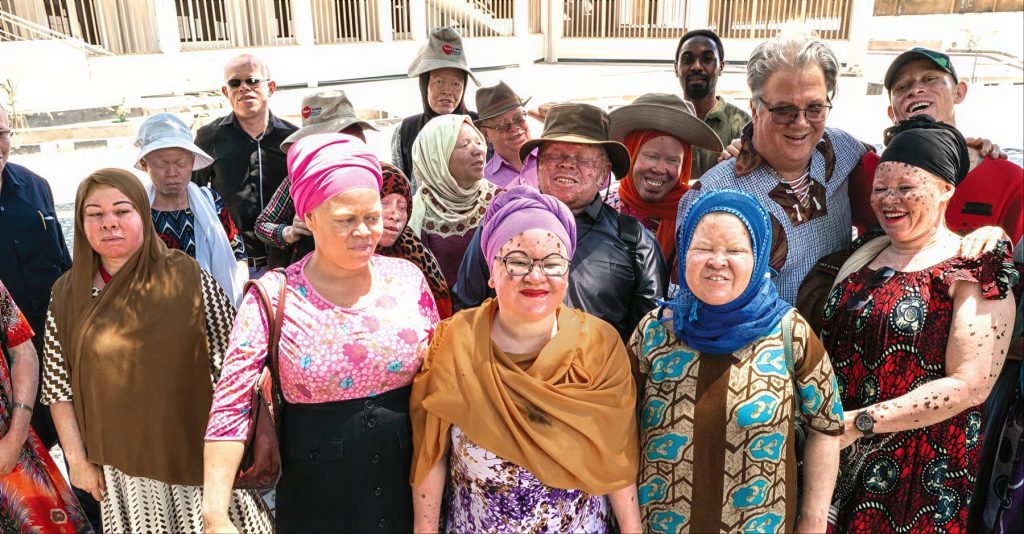 Ministry for People with Albinism